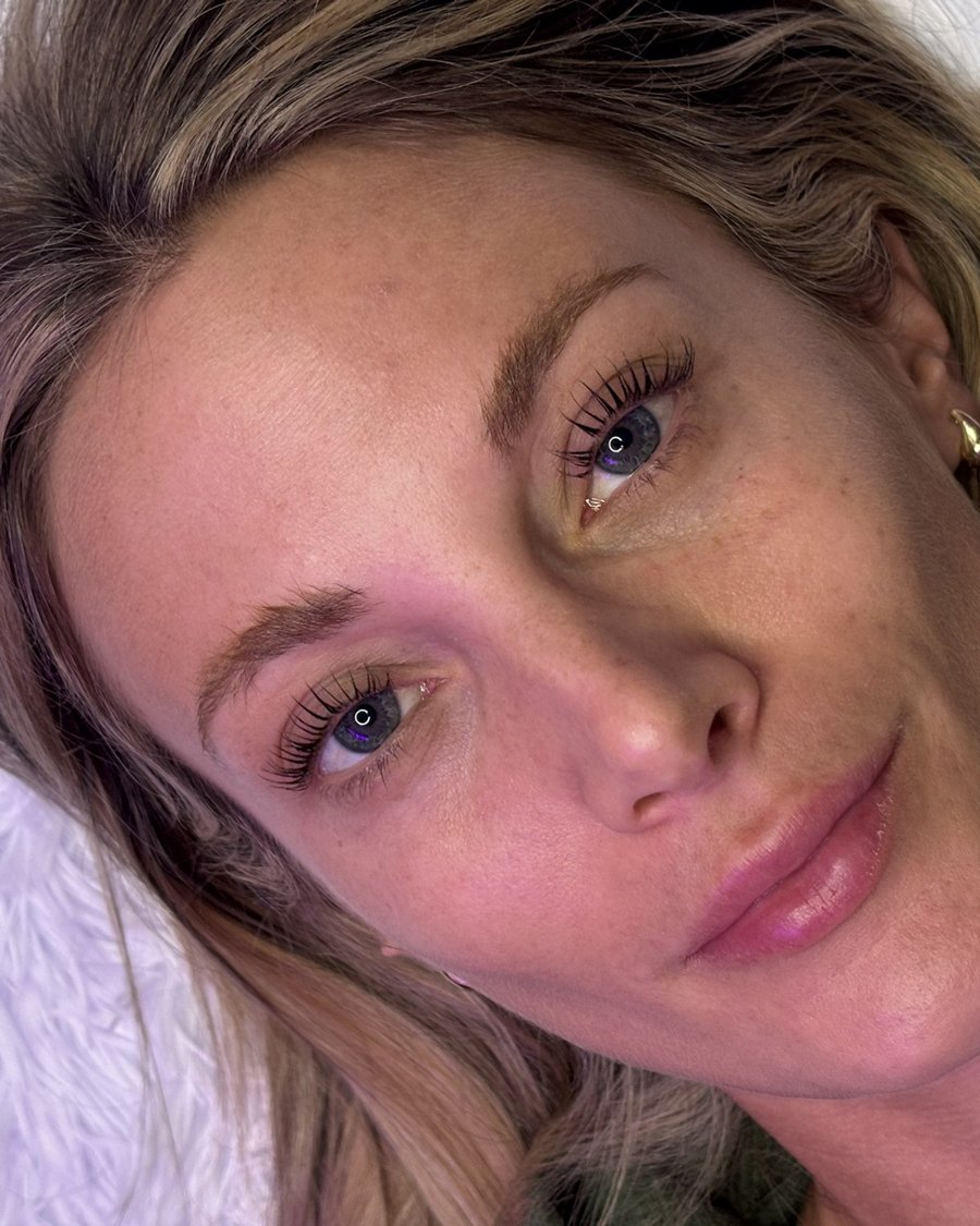 Lash lift after
